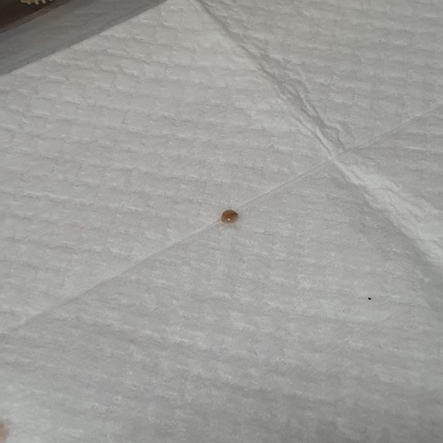 새끼강아지가 젤리변?혈변?을 봅니다의 0번 째 이미지