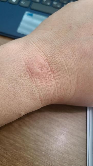 갤 워치 6 사용 중 피부 알러지가 발생 했습니다. 제품 교환하면 괜찮은가요.의 0번 째 이미지