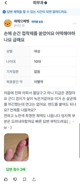 순간접착제가 손가락에 들이부어져서 살이 화상입은거같아용의 0번 째 이미지