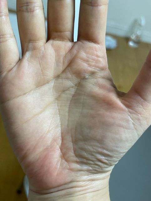 여자 오른쪽 손금 생명줄 짧으면 .. 안좋나요?의 0번 째 이미지