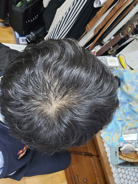 중학교 3학년 인데 정수리가 너무 보여요의 2번 째 이미지