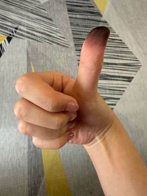 ㅠㅠ염색약이 손에 묻었는데 안지워져요 ㅠㅠ속상해요의 0번 째 이미지