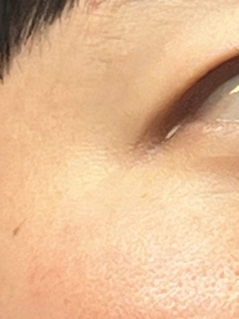 눈옆 끝에 접히는부분에 하얗게 끼는건 왜이런거죠?????의 0번 째 이미지