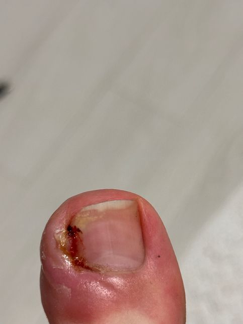 공장에서 근무하다가 다쳤는데 산재처리 가능한지 여쭙고 싶어요의 0번 째 이미지