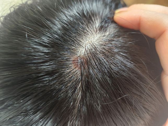 머리에 큰 점이 있어요. 사진있음..의 0번 째 이미지