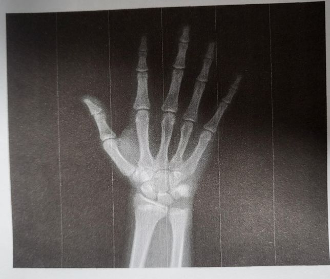 키 성장 아예 못할까요...????의 0번 째 이미지