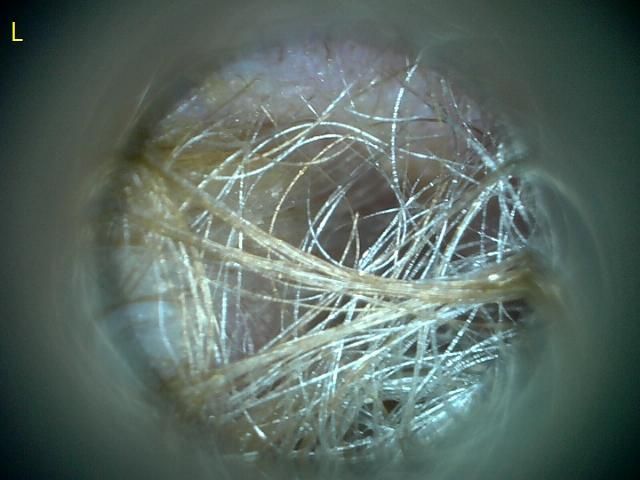 강아지 검이겸 그리고 현미경 검사 결과좀 봐주시면 감사하겠습니다.의 0번 째 이미지