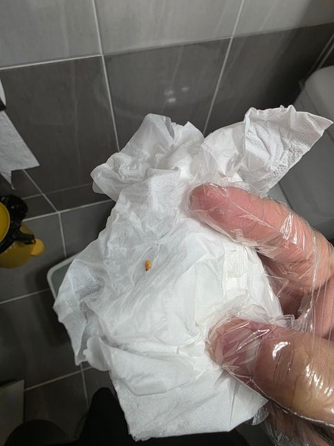 깨일까요? 벌레의 알일까요????의 0번 째 이미지