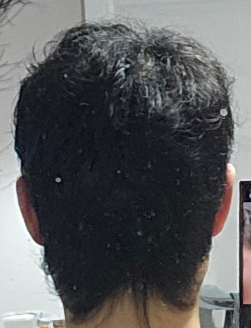 남자 뒷머리가 갈라져요. 어떻게 해야할까요?의 0번 째 이미지