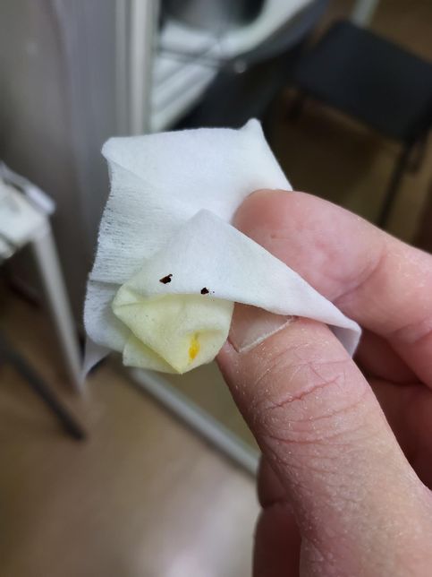 유자차 먹는데 갈색+검은 껍질 같은게 나왔는데요의 0번 째 이미지