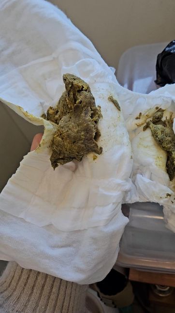 대변 양상 한번 봐주시면 감사하겠습니다.의 0번 째 이미지