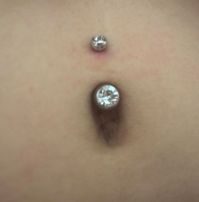 배꼽피어싱 한지 일주일 됐는데 이거 염증인가요?의 0번 째 이미지
