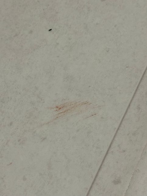 강아지가 갑자기 똥꼬스키를 해요 ㅜㅜㅜ의 3번 째 이미지