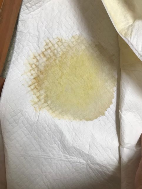 강아지 혈뇨의 원인이 신장결석 때문일수도 있나요?의 0번 째 이미지