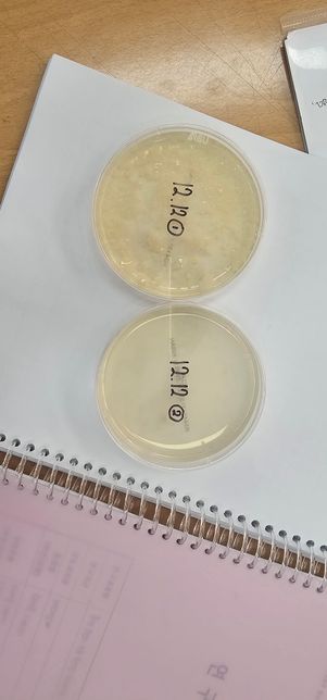 배지에 플라스틱 용액을 얇게 깔고 흙 속 미생물도 깔고 난 3일 후 하얀색 점과 노란색 점이 올라왔는데 실험 해석해주실 분 있으신가요?의 0번 째 이미지