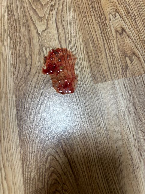 고양이가 쇠 이물질 먹고 피를 토했어요의 0번 째 이미지