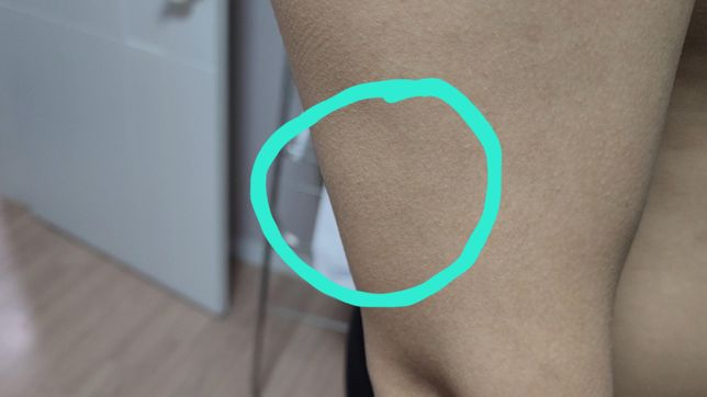 팔 근육이 불규칙적으로 팔딱팔딱 뛰어요. 하루에 다섯 번 이상 느껴져요의 0번 째 이미지