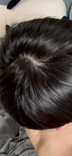이거 정수리 탈모인가요 걱정되서 올려봅니다의 2번 째 이미지