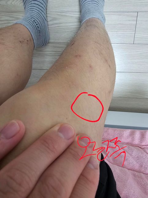 9월10일에 신호등없는횡단보도사고의 0번 째 이미지