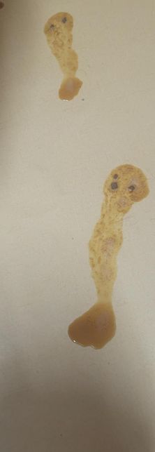 강아지가 아침에 토를했는데 색깔이 지금까지 본 토색중에 처음보는 색깔이에요의 0번 째 이미지