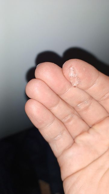 집안에서 발견된 이상한 액체에 대해 알고 싶습니다.의 1번 째 이미지