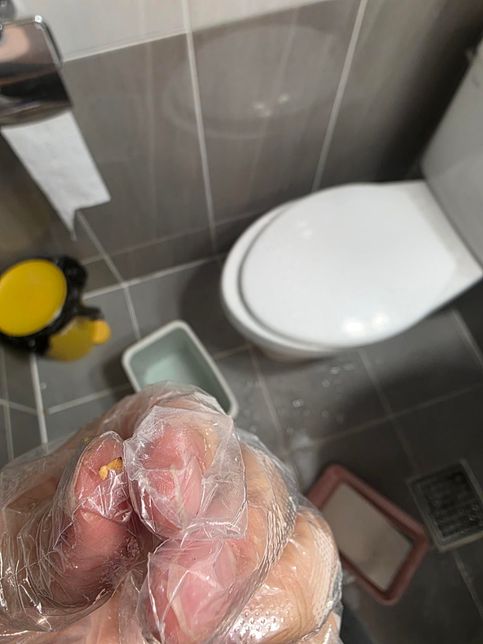 깨일까요? 벌레의 알일까요????의 1번 째 이미지