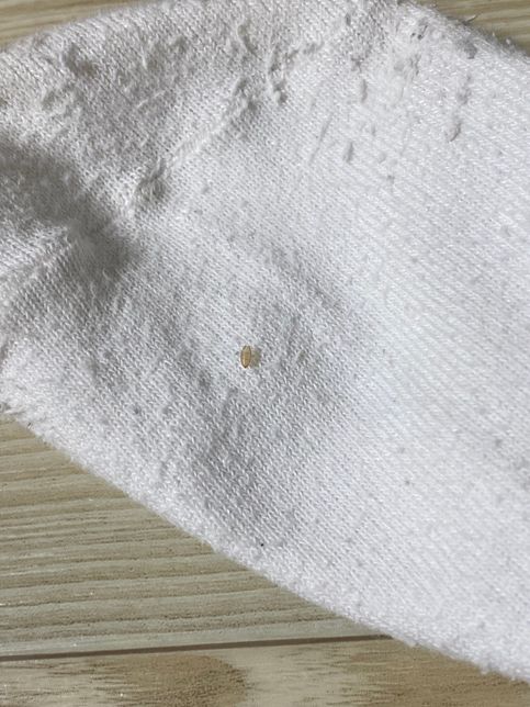 탈피허물로 어느 벌레인지 알 수 있을까요?의 0번 째 이미지