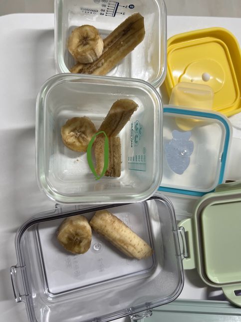 바나나 냉장보관 후 갈색 반점들 봐주세요의 0번 째 이미지