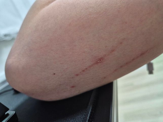 스토킹에 대해서 사건이 생겨서 문의 드립니다.의 0번 째 이미지