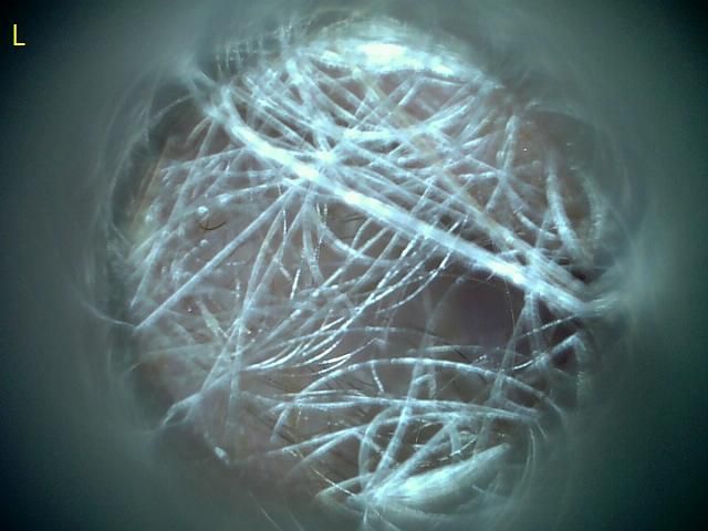 강아지 검이겸 그리고 현미경 검사 결과좀 봐주시면 감사하겠습니다.의 2번 째 이미지