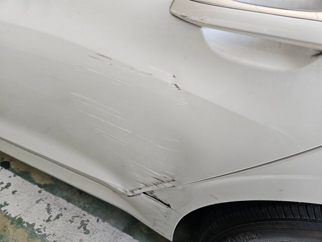 뒷자리 차 긁힘 수리비 얼마 나올까요?의 0번 째 이미지