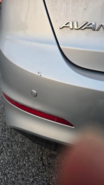 오토바이 타다가 사고가 났는데요ㅠ.의 0번 째 이미지