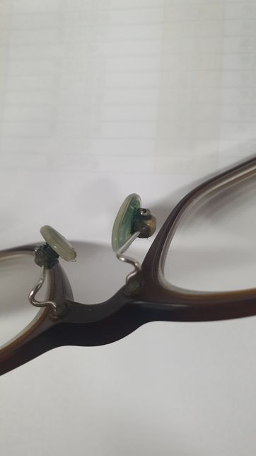 안경코받치에 녹색으로 생기는 저건 왜죠?의 0번 째 이미지