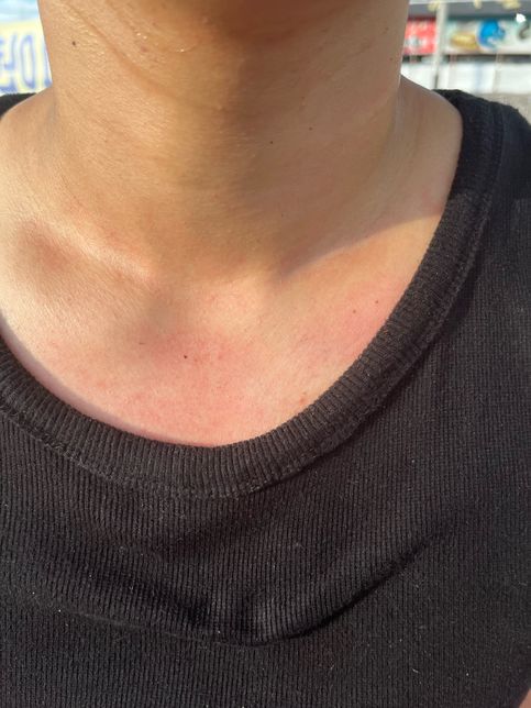 폭행관련 형사접수 및 쌍방이 가능한지의 0번 째 이미지