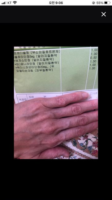 알러지약 알아서 줄여먹으라는데 어떻게 먹는게 좋을까요?의 0번 째 이미지