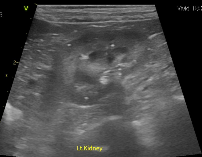 강아지 신장결석 종류 모양만으로는 추측도 불가능한가요?의 0번 째 이미지