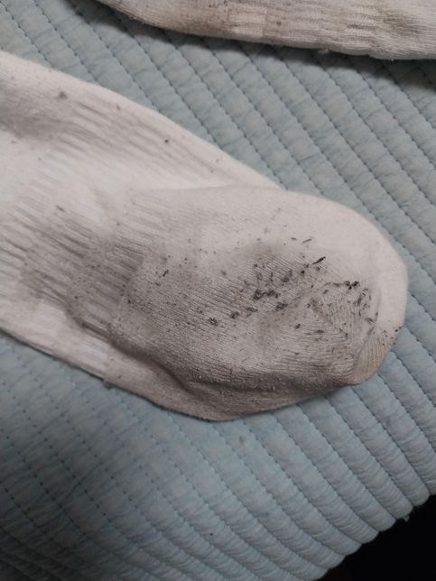 양말이 왜이럴까 좀 봐주세요. 해결방법도 궁금합니다.의 3번 째 이미지