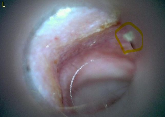 강아지 귀안 검은색 저 부분이 대체 뭘까요?의 3번 째 이미지