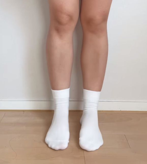 종아리 안쪽 알 없애는 방법 없나요??의 0번 째 이미지