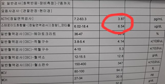 스테로이드 금단증상 회복될까요??의 1번 째 이미지