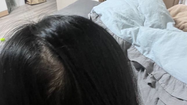 딋가르마는 어떻게 없애나요?? ㅠㅠ의 0번 째 이미지