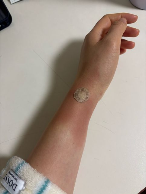 마취 주사 (혈관 터짐, 알러지반응) 의료 보상의 1번 째 이미지