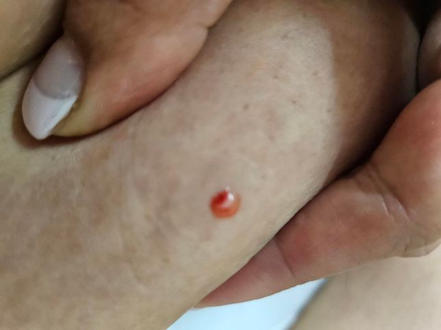 저 마운자로 잘못맞은건지 한번 봐주세요의 0번 째 이미지