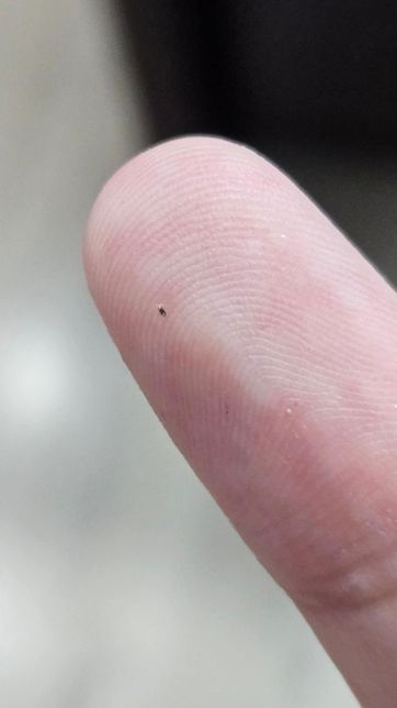 이게 무슨 벌레인가요? 진드기같기도 하고 벼룩같기도 하고의 0번 째 이미지