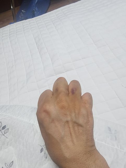 노무사님 산재 장해등급 관련 문의드립니다ㅜ의 0번 째 이미지