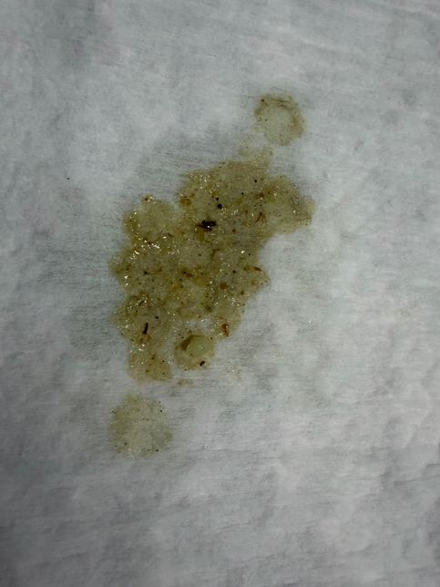 강아지 장폐색 인가요? 토사진있어요의 0번 째 이미지