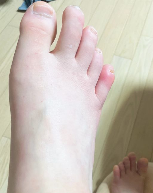 족욕 후 사진이에요 괜찮나요..??의 0번 째 이미지