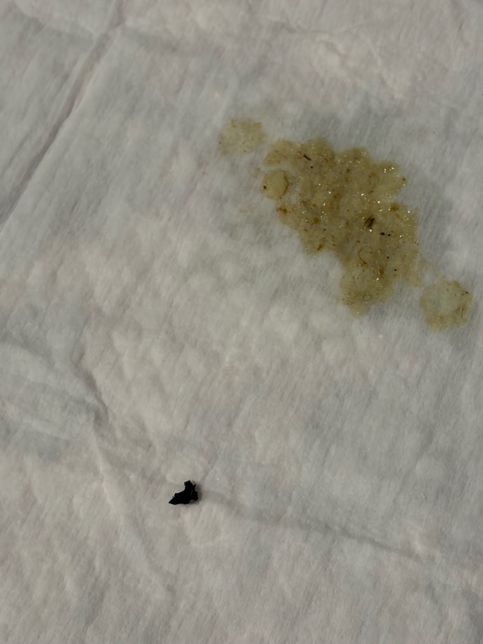 강아지 장폐색 인가요? 토사진있어요의 2번 째 이미지