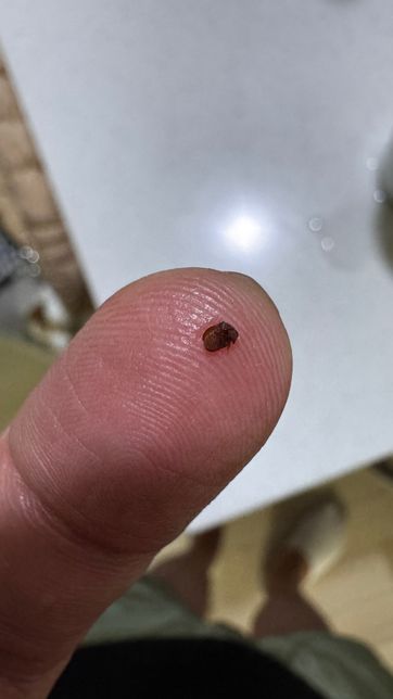 이 벌레 뭔지 아시나요 미칠꺼 같네요ㅠㅠ의 2번 째 이미지