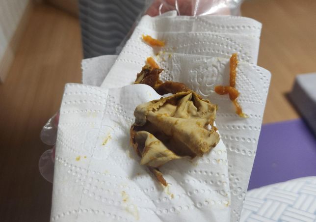 5개월 좀 넘은 말티푸가 배변했는데 변 안에 돌돌 말린의 0번 째 이미지